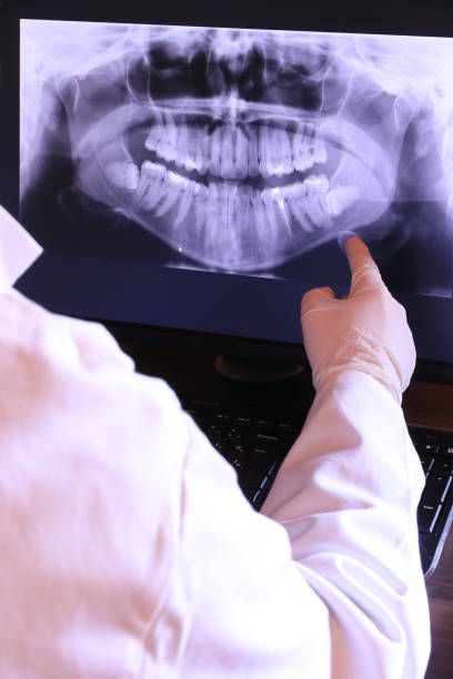 Best Emergency Root Canal Treatment in Shaker Heights, OH